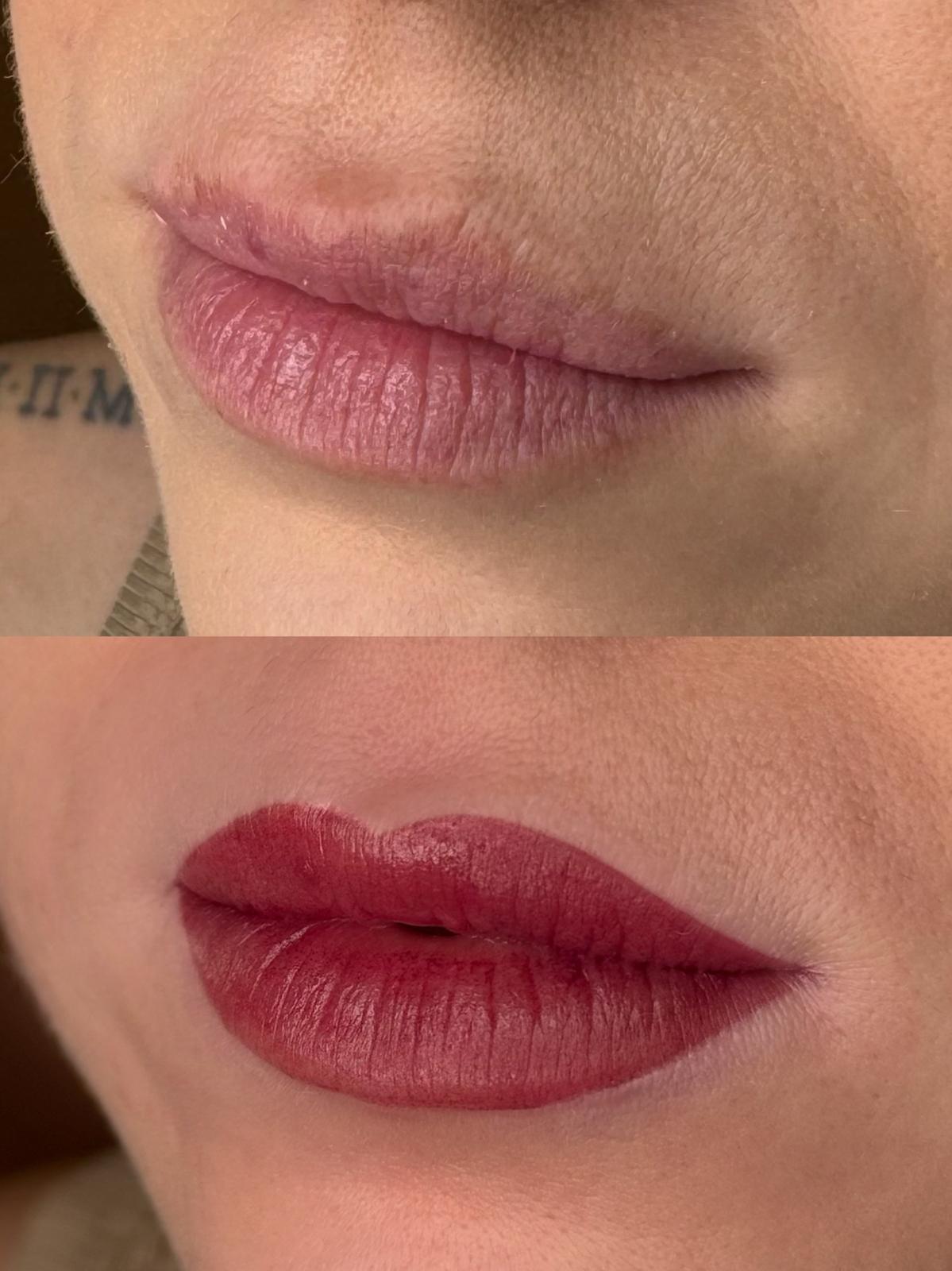 Prima e dopo trattamento labbra realizzato da Paola Benchea